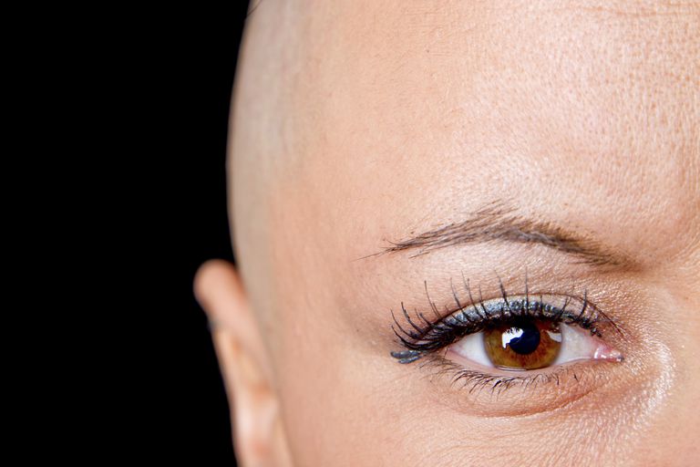 utrata włosów, włosów chemioterapii, części ciała, komórki rakowe, Odrastanie włosów chemioterapii, podczas inne