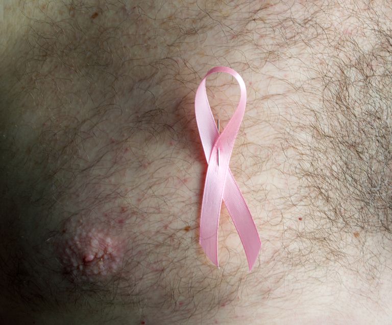 raka piersi, piersi mężczyzn, raka piersi mężczyzn, tkanki piersi, piersi jest, tkankę piersi