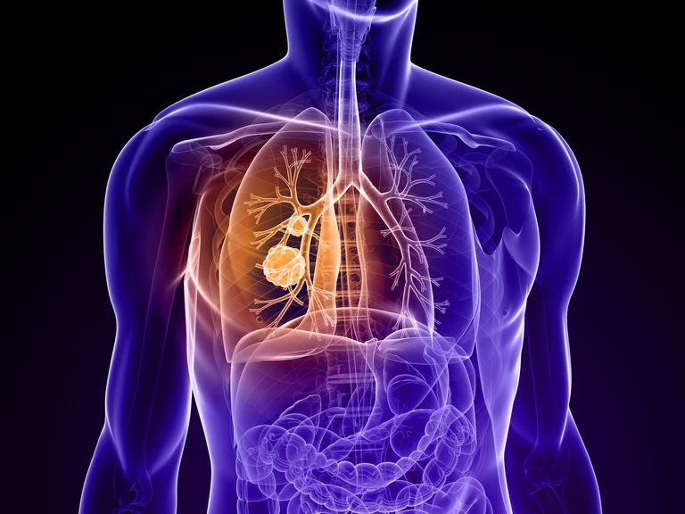 raka płuc, masy płuc, masa płuc, płuc jest