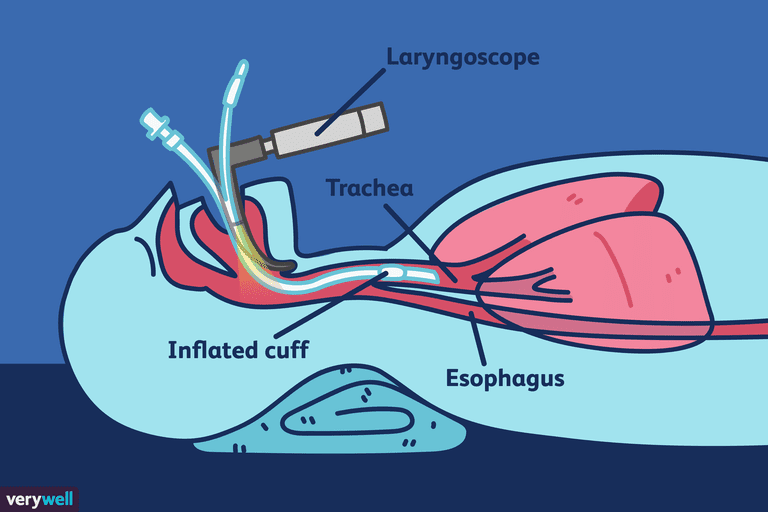 dróg oddechowych, jamy ustnej, jest intubacja, pacjent może, podczas intubacji