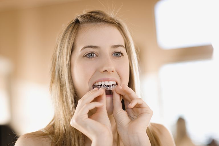 wybielania zębów, może pomóc, zębów jest, łagodniejsze zębów, nadwrażliwość zębów, postępować zgodnie