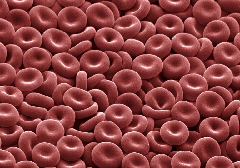 czerwonych krwinek, może powodować, szpiku kostnym, chorób przewlekłych, czerwone krwinki, czerwonych krwinek krążeniu