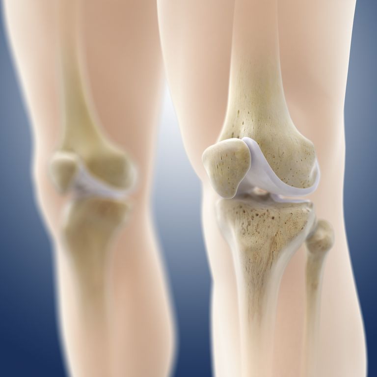 stawu kolanowego, transferu chrząstki, krokiem jest, uszkodzenia chrząstki, Chirurgia stawu, Chirurgia stawu kolanowego