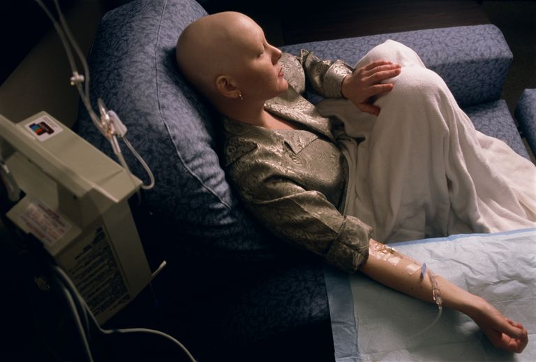 raka okrężnicy, działania niepożądane, stadium raka, chemioterapia jest