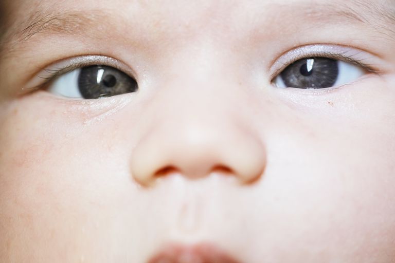 oczy noworodka, dziecko problem, Jeśli Twoje, może również