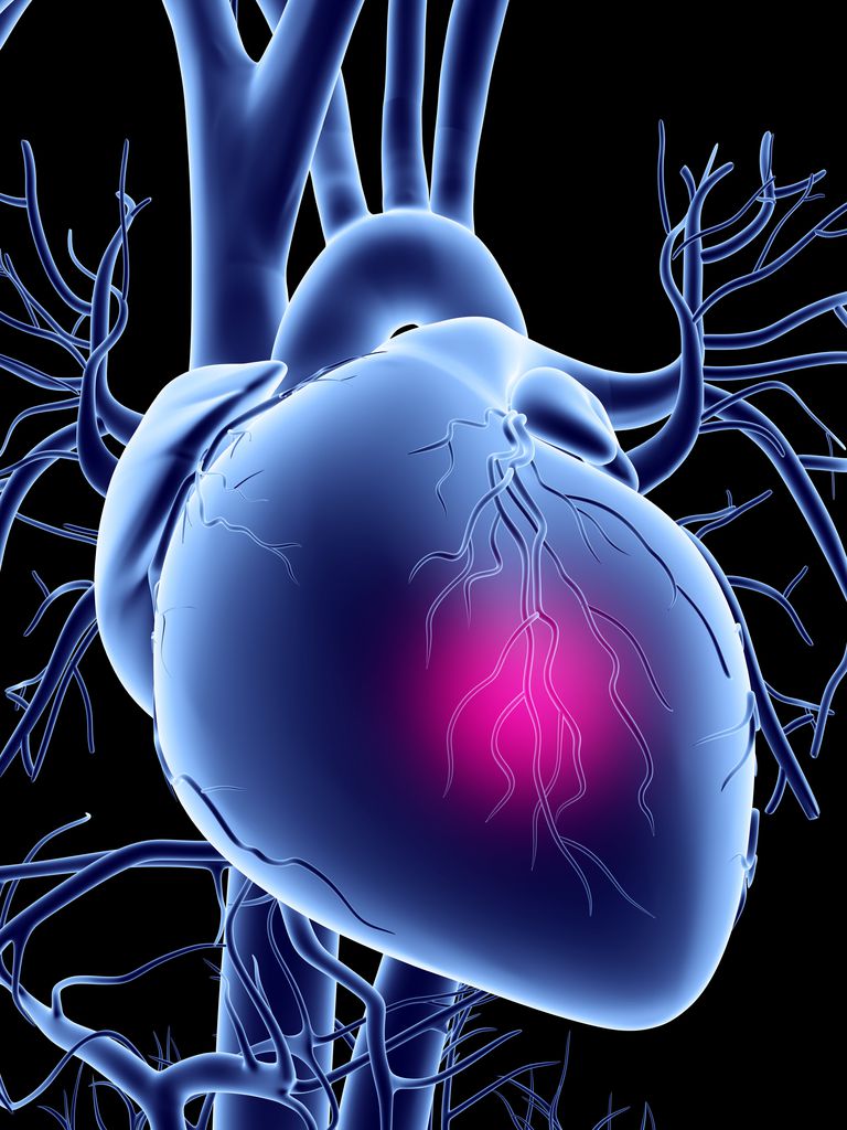 mięśnia sercowego, tętnic wieńcowych, testy wysiłkowe, tętnicach wieńcowych