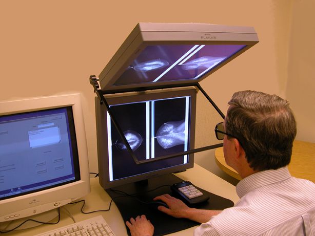 kobiet które, mammografia filmowa, radiolog może, badanie porównujące