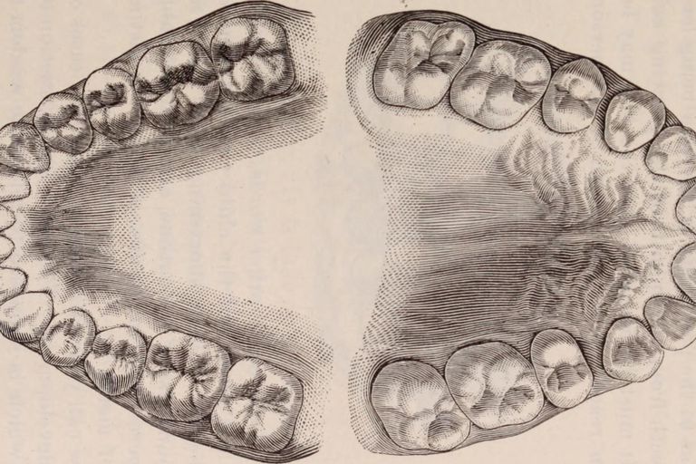 zęby trzonowe, które mogą, zębów mądrości, zębów trzonowych, zęby mądrości