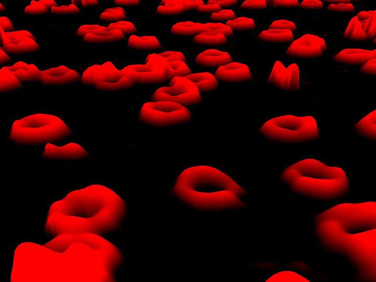 czerwonych krwinek, poziom hemoglobiny, szpiku kostnego, które mogą, hemoglobiny jest