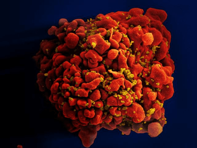 AIDS jest, układ odpornościowy, jest akronimem, milionów ludzi, odporności jest, odpornościowy organizmu
