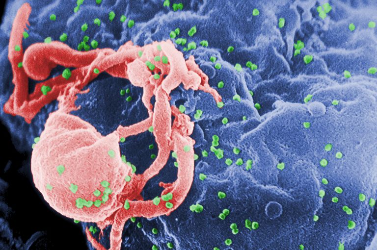 komórki komórki, krążący wirus, modele szczepionek, rozwija AIDS