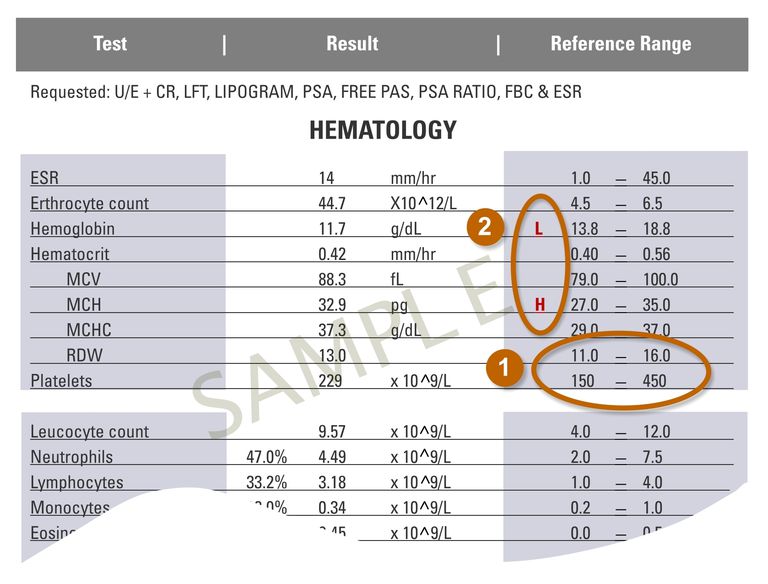 Artykuł źródłowy, hematologiczny próbka, Kaskada leczenia, następnie porównywane, odczytać raport