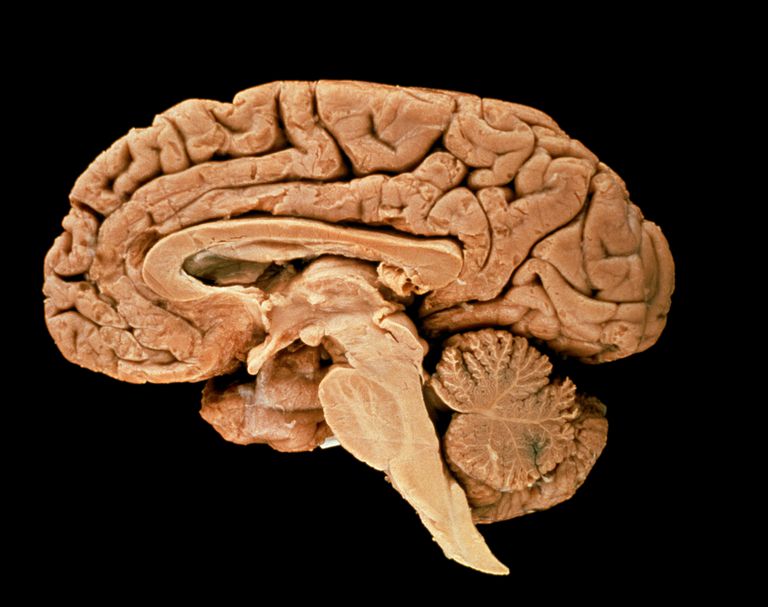 pnia mózgu, części pnia, części pnia mózgu, Pień mózgu, rozsiane wpływa