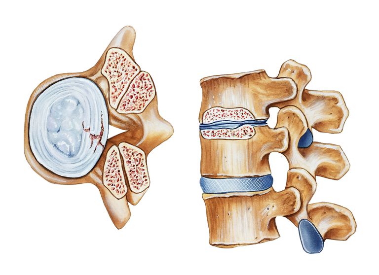 kanału kręgowego, boczne wgłębienie, kości kręgosłupa, trzonu kręgu, bocznej wnęki