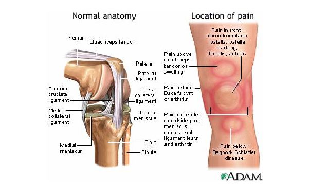 stawu kolanowego, bólu rzepkowo-udowego, kość udowa, kości udowej, mięśnia czworogłowego