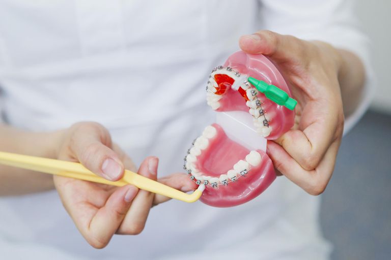 asystenta ortodonta, asystentem ortodonta, asystentem ortodonta może, asystentów dentystycznych, asystentów ortodontów