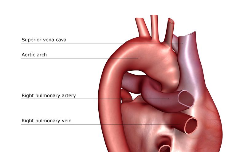 nadciśnienie płucne, naszego serca, tętnicy płucnej, tętnic które, bogatą tlen