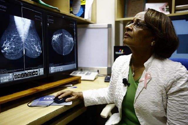 raka piersi, jaki jest, mieć chemioterapię, biopsji piersi, błonę podstawną