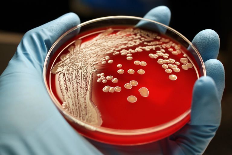 MRSA jest, Staphylococcus aureus, bardziej narażone, infekcje MRSA