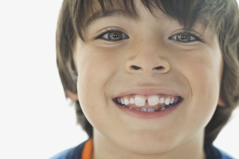 aparatów ortodontycznych, Twoje dziecko, aparaty ortodontyczne, dróg oddechowych, dziecko powinno, krzywe zęby
