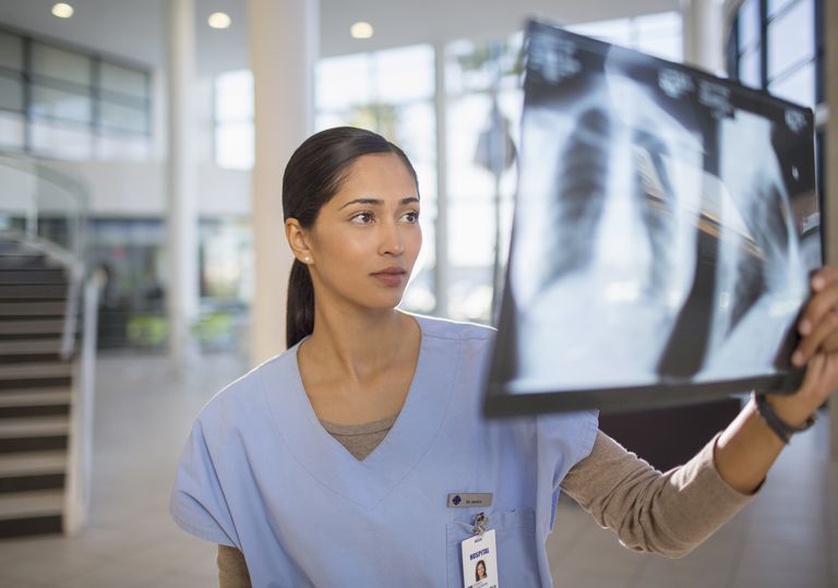 klatki piersiowej, zdjęciu rentgenowskim, cień płucach, struktury takie, raka płuc