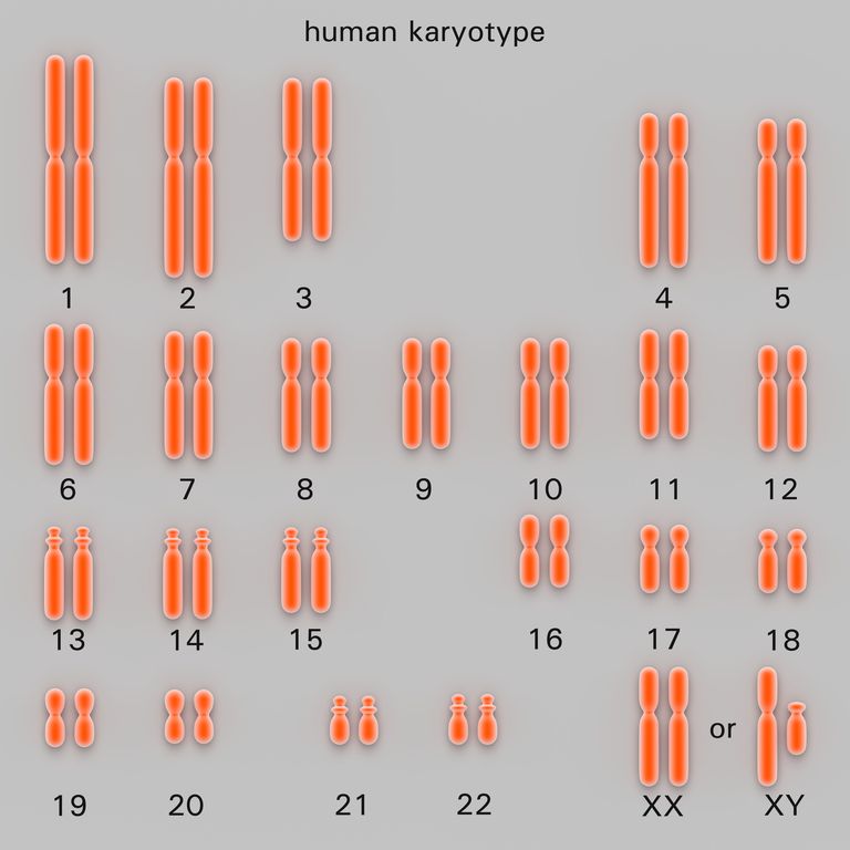 jednego chromosomu, kariotypu może, liczbę chromosomów, nieprawidłowości chromosomalne, Trisomia zespół, zespół Downa