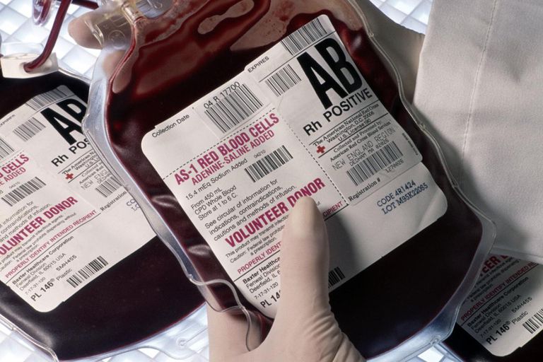transfuzję krwi, krwi jest, grupą krwi, która jest, rodzajów krwi, transfuzji krwi