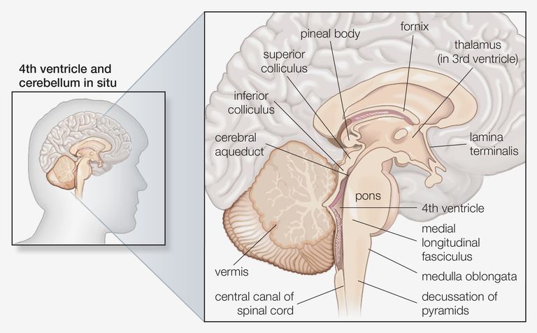 jednej stronie, mózgu jest, pnia mózgu, zawroty głowy, bóle głowy