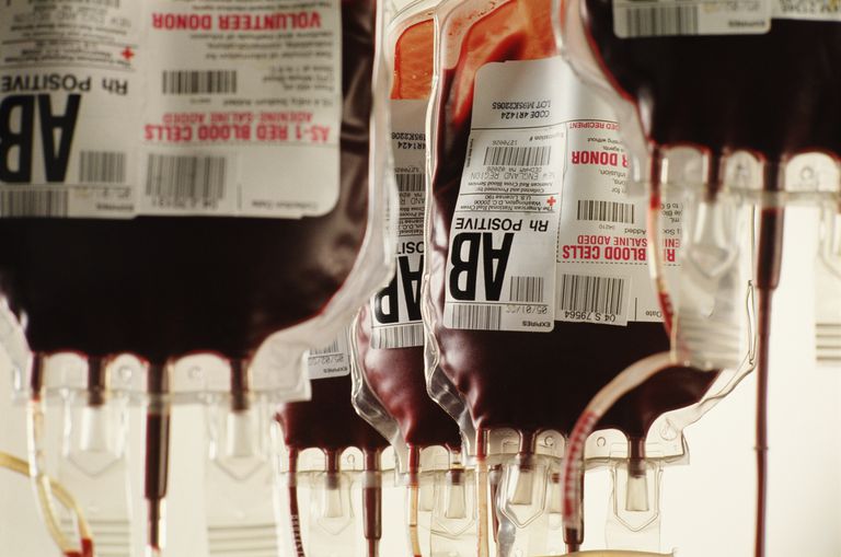 krwi dawcy, krew jest, Krew może, transfuzji krwi, dawcy jest, Dopasowanie krzyżowe
